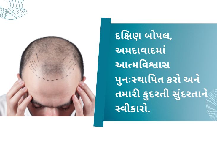 ડૉ. આનંદ બી. શાહ સાથે ફરી મેળવો આત્મવિશ્વાસ અને મેળવો કુદરતી લૂક સાઉથ બોપલ, અમદાવાદમાં