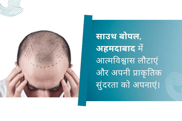 डॉ. आनंद बी. शाह के साथ आत्मविश्वास लौटाएं और पाएं नैचुरल लुक साउथ बोपल, अहमदाबाद में